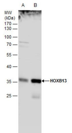 Invitrogen HOXB13 Polyclonal Antibody 100 &mu;L; Unconjugated:Antibodies,