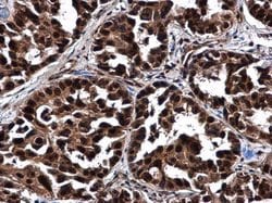Invitrogen NOP56 Polyclonal Antibody 100 &mu;L; Unconjugated:Antibodies,