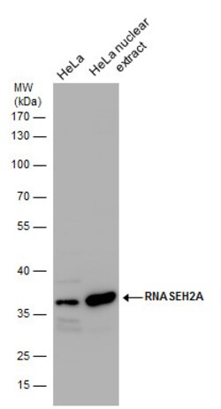 Invitrogen RNAse H2A Polyclonal Antibody 100 &mu;L; Unconjugated:Antibodies,