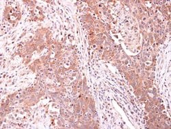 Invitrogen ARPC1A Polyclonal Antibody 100 &mu;L | Buy Online | Invitrogen&trade; | Fisher Scientific