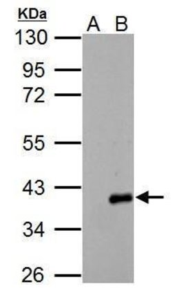 Invitrogen ARPC1A Polyclonal Antibody 100 &mu;L | Buy Online | Invitrogen&trade; | Fisher Scientific