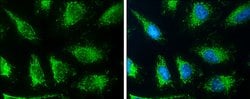Invitrogen SLC19A2 Polyclonal Antibody 100 &mu;L; Unconjugated:Antibodies,