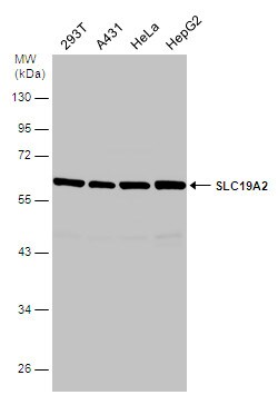 Invitrogen SLC19A2 Polyclonal Antibody 100 &mu;L; Unconjugated:Antibodies,