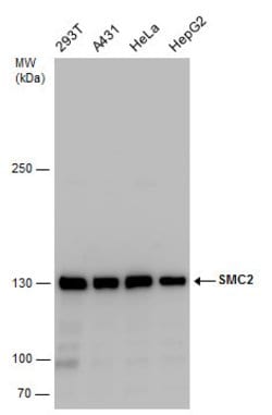 Invitrogen SMC2 Polyclonal Antibody 100 &mu;L; Unconjugated:Antibodies,