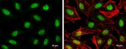 Invitrogen STAG2 Polyclonal Antibody 100 &mu;L; Unconjugated:Antibodies,
