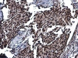 Invitrogen STAG2 Polyclonal Antibody 100 &mu;L; Unconjugated:Antibodies,