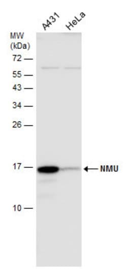 Invitrogen Neuromedin U Polyclonal Antibody 100 &mu;L | Buy Online | Invitrogen&trade; | Fisher Scientific