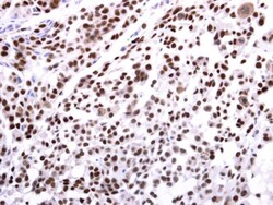 Invitrogen EHMT2 Polyclonal Antibody 100 &mu;L; Unconjugated:Antibodies,