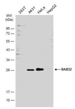 Invitrogen RAB32 Polyclonal Antibody 100 &mu;L | Buy Online | Invitrogen&trade; | Fisher Scientific