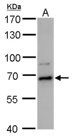 Invitrogen DDX52 Polyclonal Antibody 100 &mu;L; Unconjugated:Antibodies,