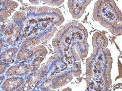 Invitrogen Coronin 1A Polyclonal Antibody 100 &mu;L; Unconjugated:Antibodies,