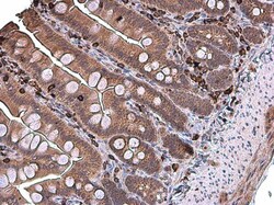 Invitrogen Coronin 1A Polyclonal Antibody 100 &mu;L; Unconjugated:Antibodies,