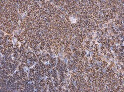 Invitrogen Coronin 1A Polyclonal Antibody 100 &mu;L; Unconjugated:Antibodies,