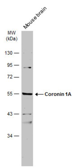 Invitrogen Coronin 1A Polyclonal Antibody 100 &mu;L; Unconjugated:Antibodies,