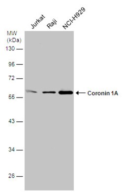 Invitrogen Coronin 1A Polyclonal Antibody 100 &mu;L; Unconjugated:Antibodies,