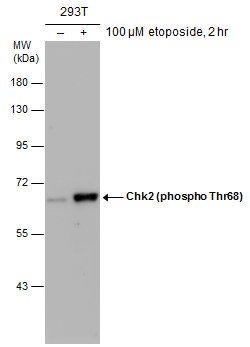Invitrogen Phospho-CHK2 (Thr68) Polyclonal Antibody 100 &mu;L; Unconjugated:Antibodies,