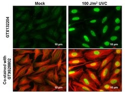 Invitrogen Phospho-CHK2 (Thr68) Polyclonal Antibody 100 &mu;L; Unconjugated:Antibodies,