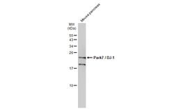 Invitrogen DJ-1 Polyclonal Antibody 100 &mu;L; Unconjugated:Antibodies,