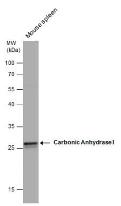 Invitrogen™ Carbonic Anhydrase I Polyclonal Antibody