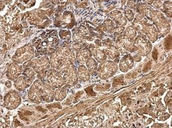 Invitrogen CDH4 Polyclonal Antibody 100 &mu;L; Unconjugated:Antibodies,