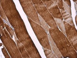 Invitrogen CDKN2C Polyclonal Antibody 100 &mu;L; Unconjugated:Antibodies,