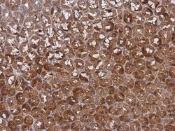 Invitrogen CDKN2C Polyclonal Antibody 100 &mu;L; Unconjugated:Antibodies,