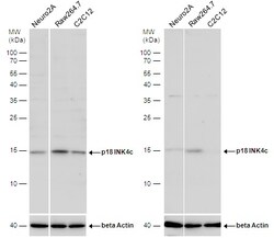 Invitrogen CDKN2C Polyclonal Antibody 100 &mu;L; Unconjugated:Antibodies,