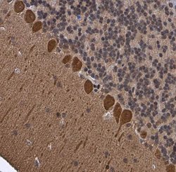 Invitrogen p130Cas Polyclonal Antibody 100 &mu;L; Unconjugated:Antibodies,