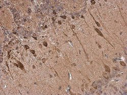 Invitrogen Dopamine Transporter Polyclonal Antibody 100 &mu;L; Unconjugated:Antibodies,