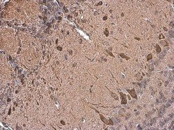 Invitrogen Dopamine Transporter Polyclonal Antibody 100 &mu;L; Unconjugated:Antibodies,