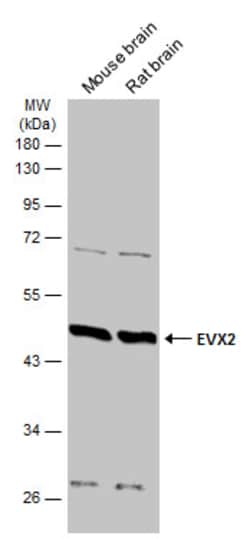 Invitrogen EVX2 Polyclonal Antibody 100 &mu;L; Unconjugated:Antibodies,