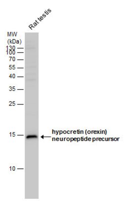 Orexin B Polyclonal Antibody, Invitrogen 100 &mu;L; Unconjugated:Antibodies,