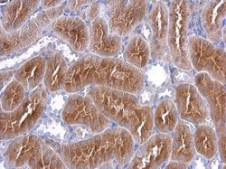 Invitrogen IHH Polyclonal Antibody 100 &mu;L; Unconjugated:Antibodies,