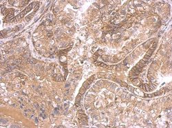 Invitrogen IHH Polyclonal Antibody 100 &mu;L; Unconjugated:Antibodies,