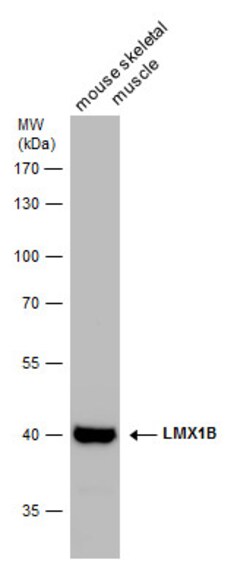 Invitrogen LMX1B Polyclonal Antibody 100 &mu;L; Unconjugated:Antibodies,