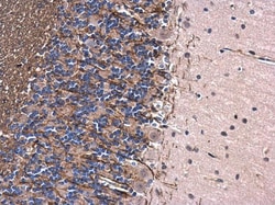 Invitrogen MBP Polyclonal Antibody 100 &mu;L | Buy Online | Invitrogen&trade; | Fisher Scientific