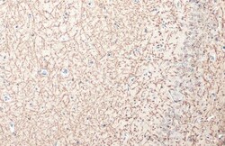 Invitrogen MBP Polyclonal Antibody 100 &mu;L | Buy Online | Invitrogen&trade; | Fisher Scientific