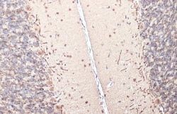 Invitrogen MBP Polyclonal Antibody 100 &mu;L | Buy Online | Invitrogen&trade; | Fisher Scientific