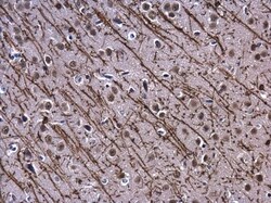 Invitrogen MBP Polyclonal Antibody 100 &mu;L | Buy Online | Invitrogen&trade; | Fisher Scientific