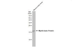 Invitrogen MBP Polyclonal Antibody 100 &mu;L | Buy Online | Invitrogen&trade; | Fisher Scientific