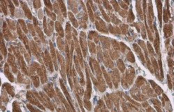 Invitrogen MYL2 Polyclonal Antibody 100 &mu;L | Buy Online | Invitrogen&trade; | Fisher Scientific