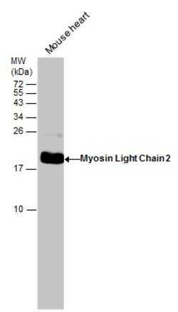 Invitrogen MYL2 Polyclonal Antibody 100 &mu;L | Buy Online | Invitrogen&trade; | Fisher Scientific