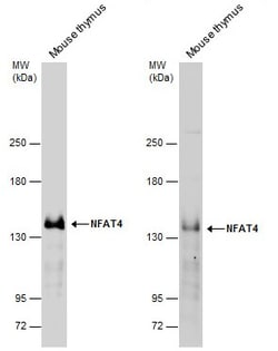 Invitrogen NFATC3 Polyclonal Antibody 100 &mu;L | Buy Online | Invitrogen&trade; | Fisher Scientific