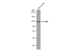 TrkB Polyclonal Antibody, Invitrogen 100 &mu;L; Unconjugated:Antibodies,