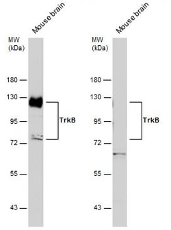 Invitrogen TrkB Polyclonal Antibody 100 &mu;L; Unconjugated:Anticuerpos
