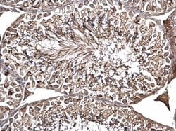ODF2 Polyclonal Antibody:Antibodies, Polyclonal