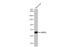 Invitrogen RPE65 Polyclonal Antibody 100 &mu;L; Unconjugated:Antibodies,