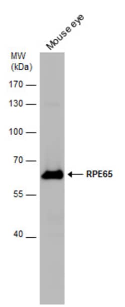 Invitrogen RPE65 Polyclonal Antibody 100 &mu;L; Unconjugated:Antibodies,