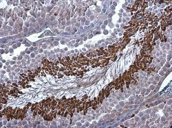 Invitrogen Brachyury Polyclonal Antibody 100 &mu;L; Unconjugated:Antibodies,