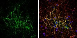 Invitrogen TIMP3 Polyclonal Antibody 100 &mu;L; Unconjugated:Antibodies,